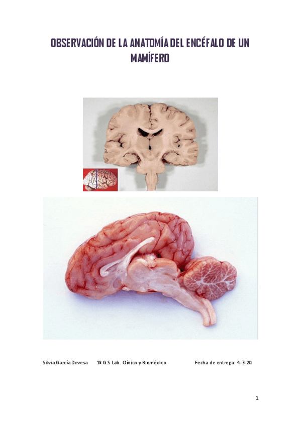 Miniatura del documento DISECCION-ENCEFALO.pdf