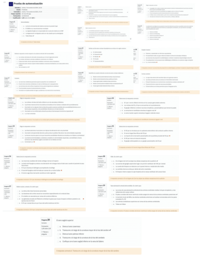Miniatura del documento Autoevaluacion-Online-2324-Revision-Para-Examen-Final.pdf