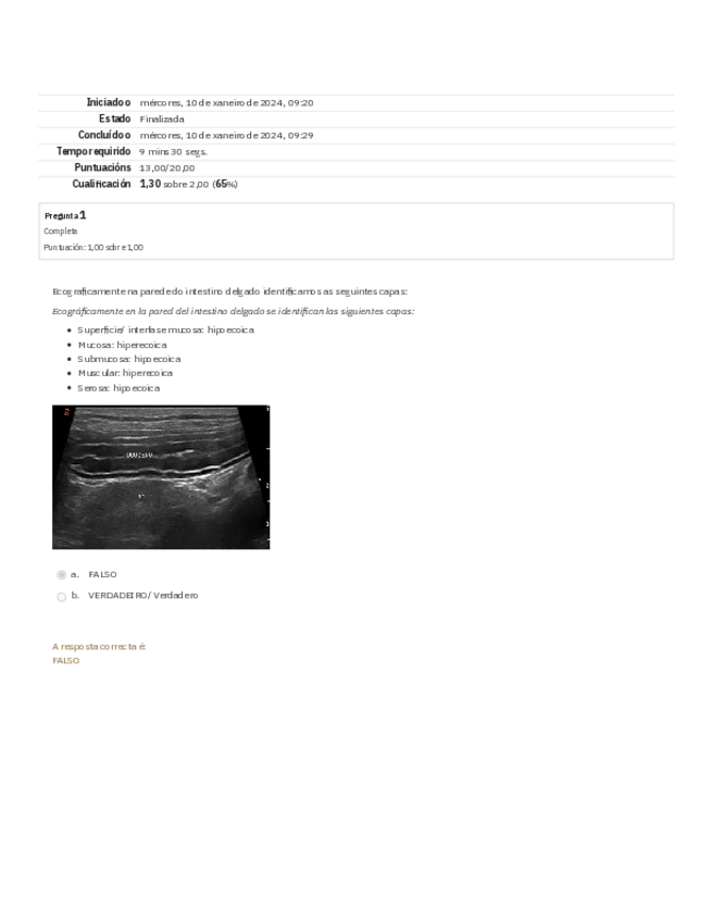 Miniatura del documento PARTE-I-EXAME-FINAL-1a-OPORTUNIDADE.pdf