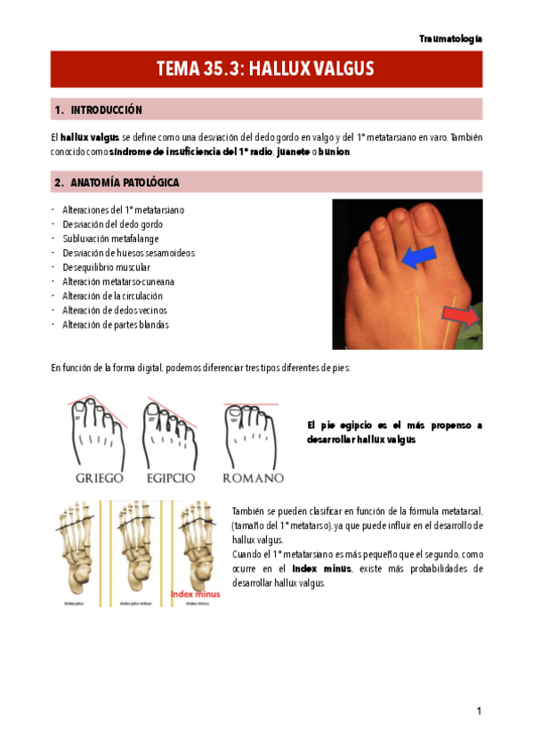 Miniatura del documento T35.3-HALLUX-VALGUS.pdf