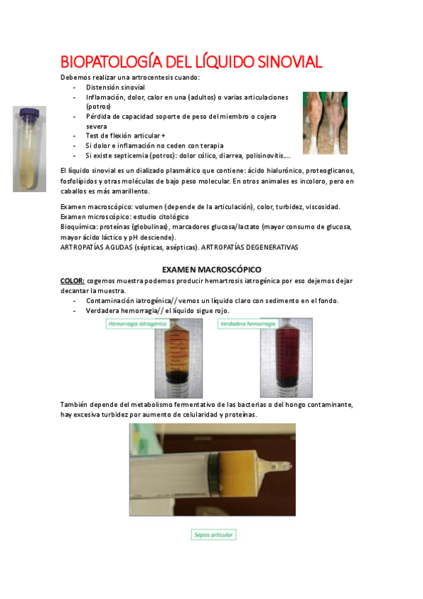 Miniatura del documento S.1y2-biopatologia-liquido-sinovial-y-efusiones-cavitarias.pdf