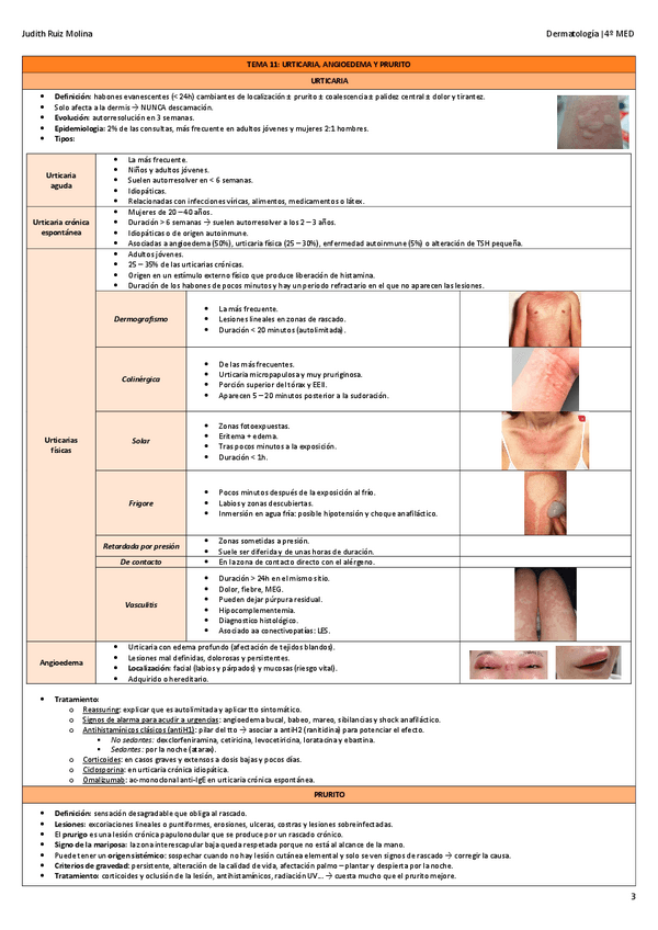 Miniatura del documento TEMA-11-URTICARIA-ANGIOEDEMA-Y-PRURITO.pdf