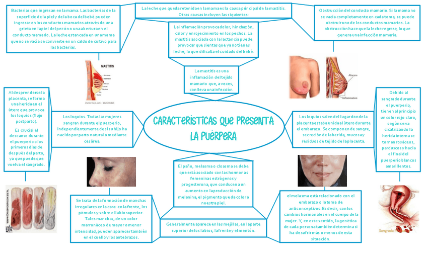 Miniatura del documento caracteristicas-de-la-puerpera.pdf