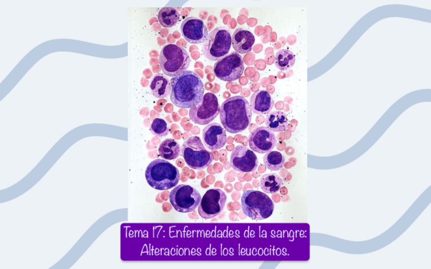 Miniatura del documento Tema-17-Enfermedades-de-la-sangre-Alteraciones-de-los-leucocitos..pdf