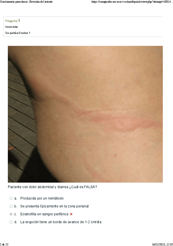 Miniatura del documento C7.-Respuestas-Parasitosis.pdf