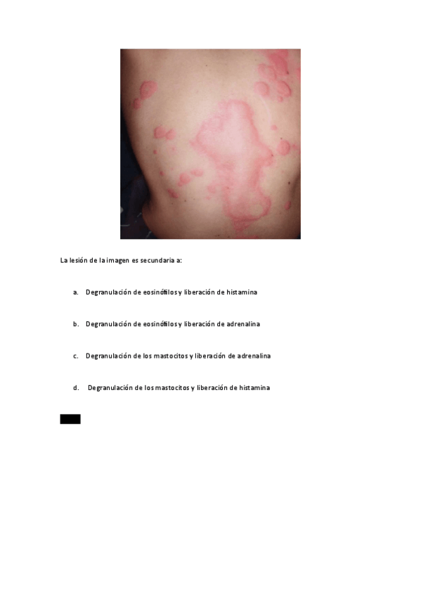 Miniatura del documento C14y26.-Uticaria-y-Toxicodermia.pdf