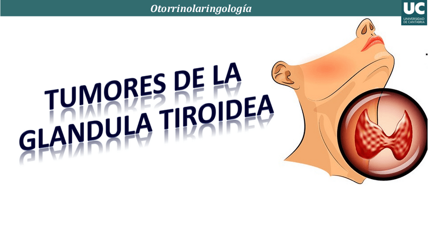 Miniatura del documento Tema-33.-patologia-tiroidea-en-ORL.pdf