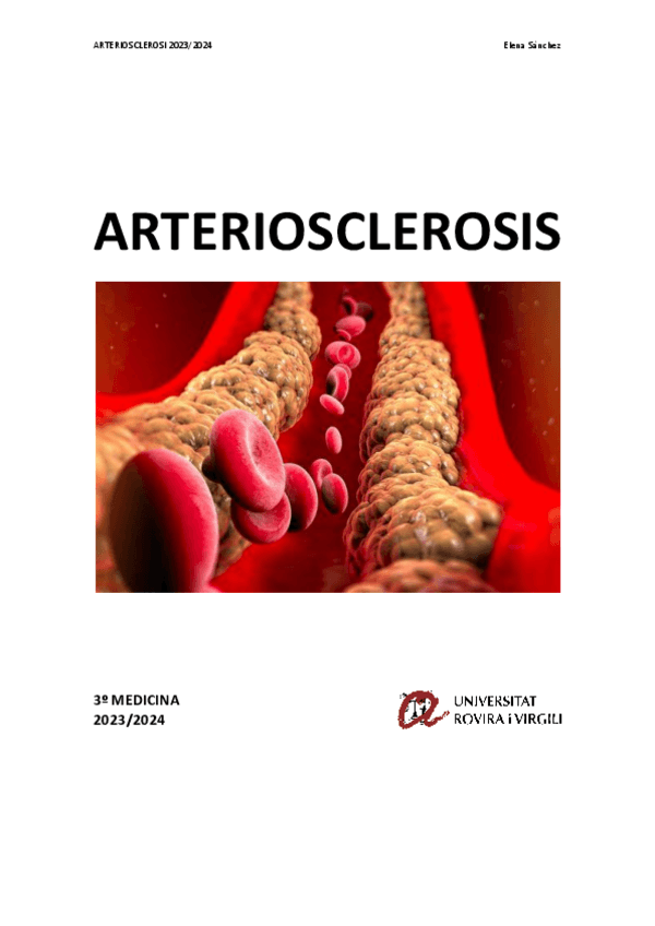 Miniatura del documento ARTERIOSCLEROSI.pdf