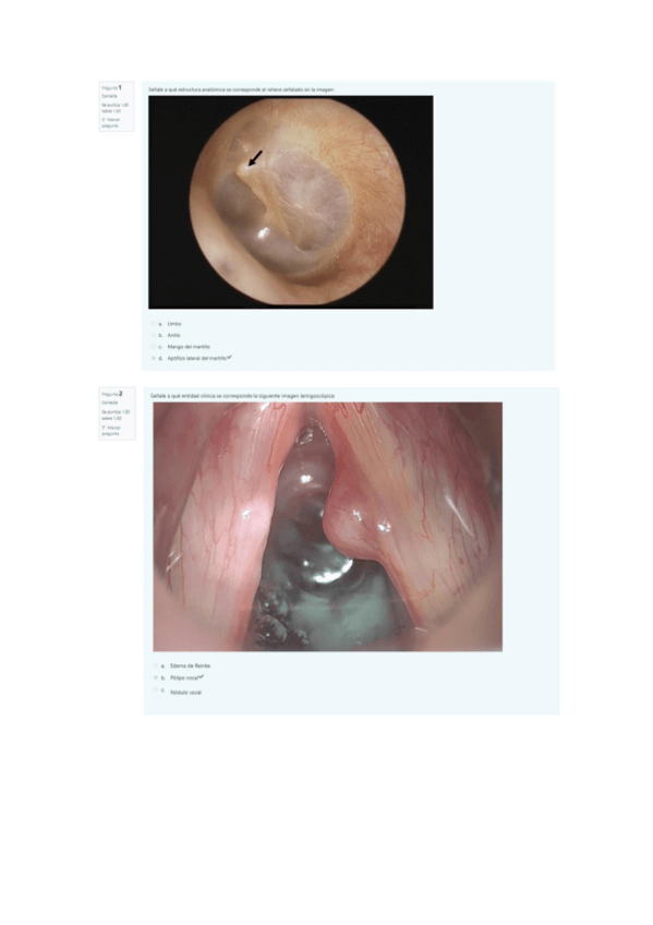 Miniatura del documento Examen-seminarios-PatVHA.pdf