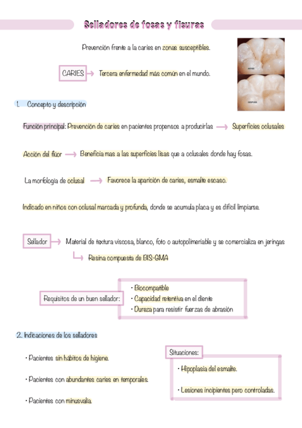 Miniatura del documento IB.-Selladores-de-fosas-y-fisuras-Tema-3.pdf