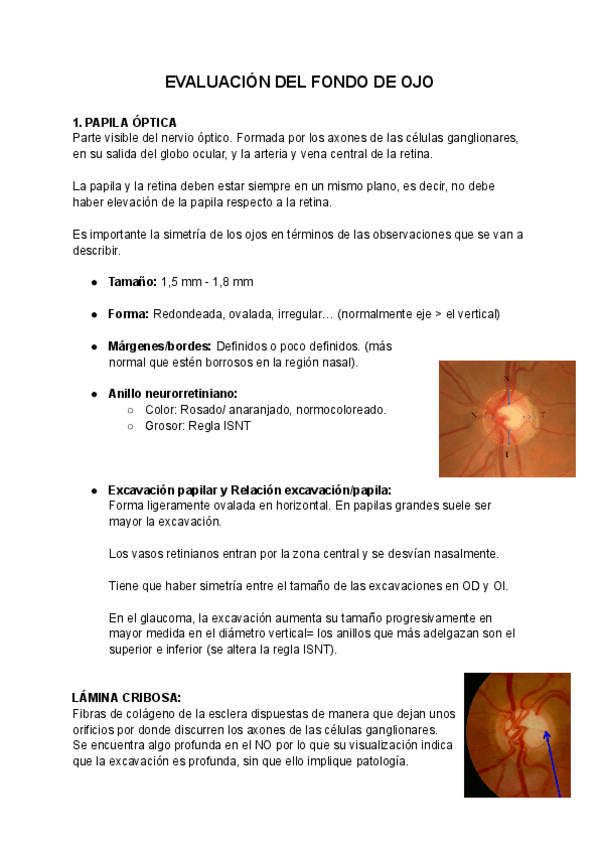 Miniatura del documento EVALUACION-DEL-FONDO-DE-OJO.pdf