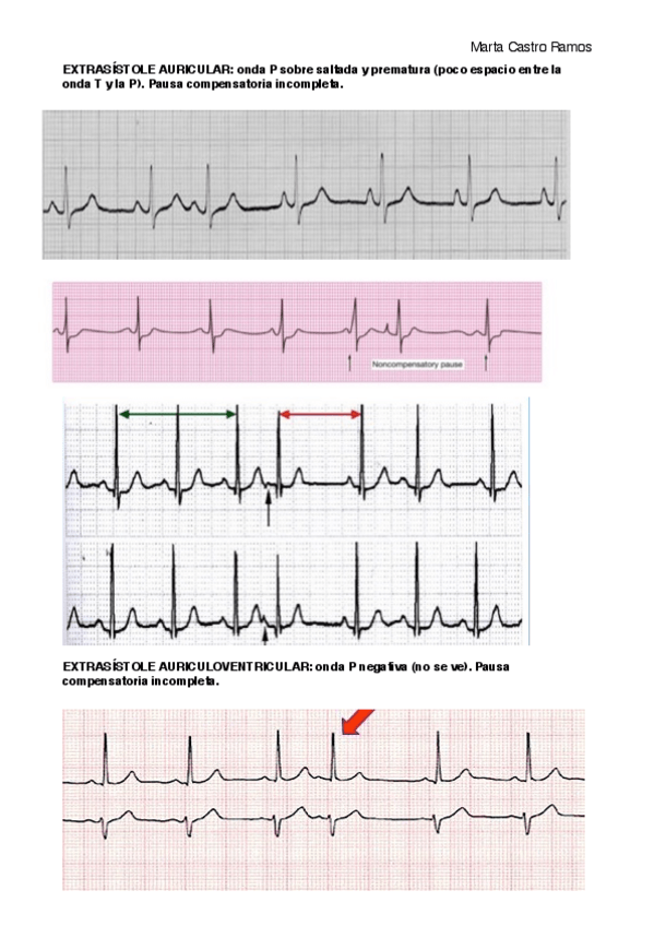 Miniatura del documento Electrocardiogramas.pdf