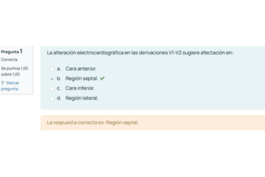 Miniatura del documento Examen-final-proce.pdf