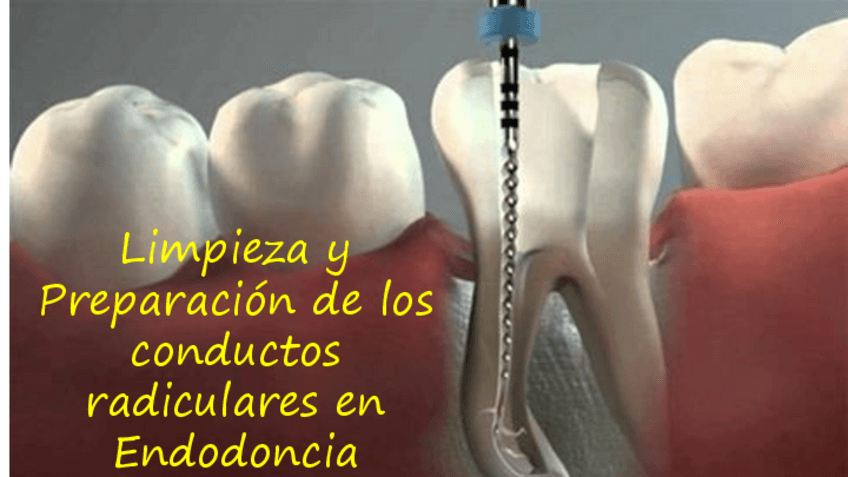 Miniatura del documento Limpieza-y-Preparacion-de-los-conductos-radiculares-en-Endodoncia.pdf