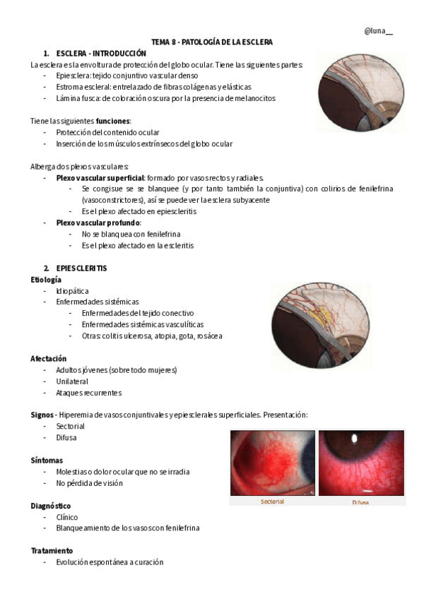 Miniatura del documento PATOLOGIA-DE-LA-ESCLERA.pdf