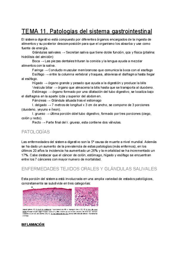 Miniatura del documento TEMA-11-Patologias-del-sistema-gastrointestinal.pdf