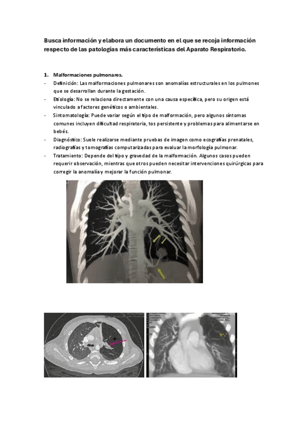 Miniatura del documento enfermedades-pulmonares.pdf
