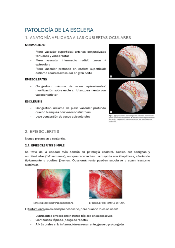 Miniatura del documento 7. Patología de la esclera.pdf
