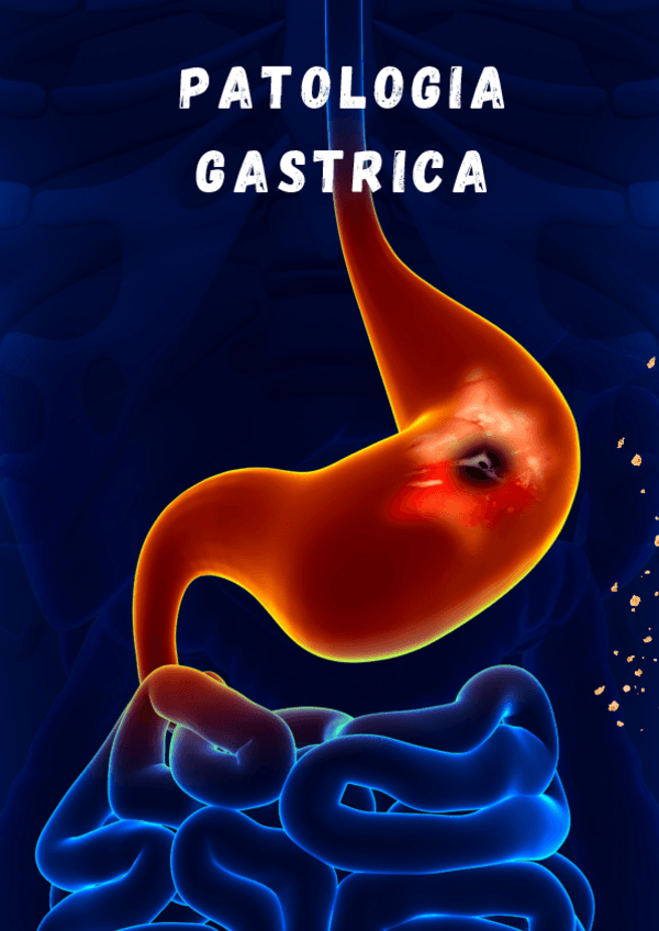 Miniatura del documento PATOLOGIA-GASTRICA.pdf