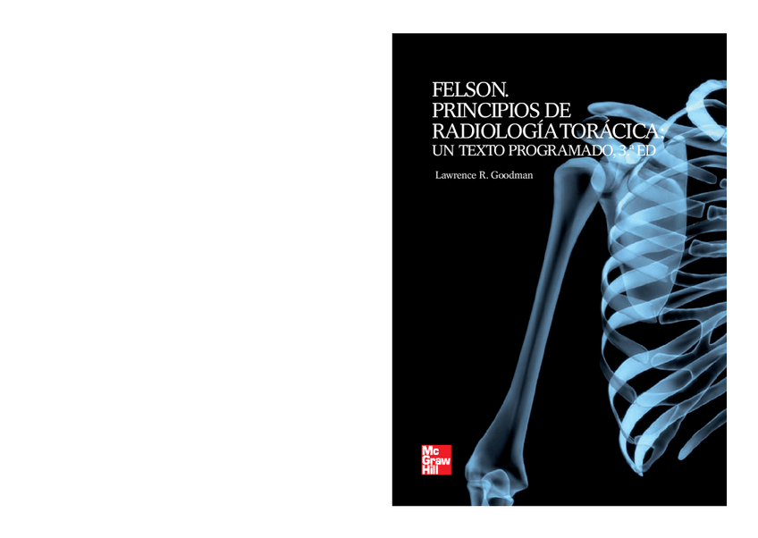 Miniatura del documento Felson-principios-de-radiologia-toracica-.pdf