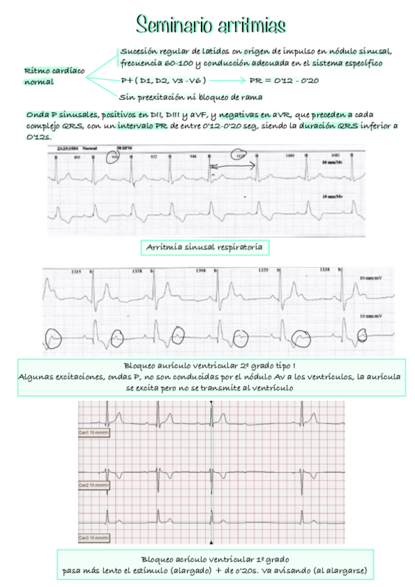 Miniatura del documento Seminario-arritmias.pdf