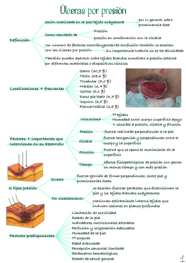 Miniatura del documento Ulceras-por-presion.pdf