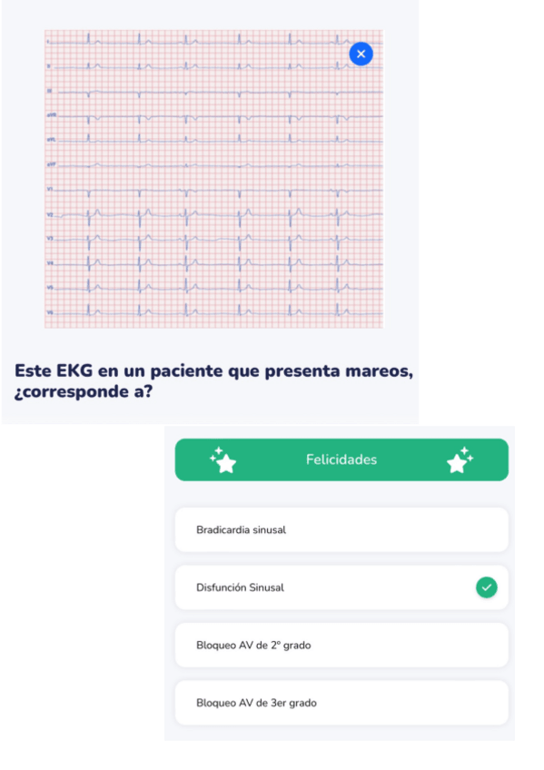 Miniatura del documento Final-wooclap-2o-taller-ECG-PAtologia-General-2.pdf