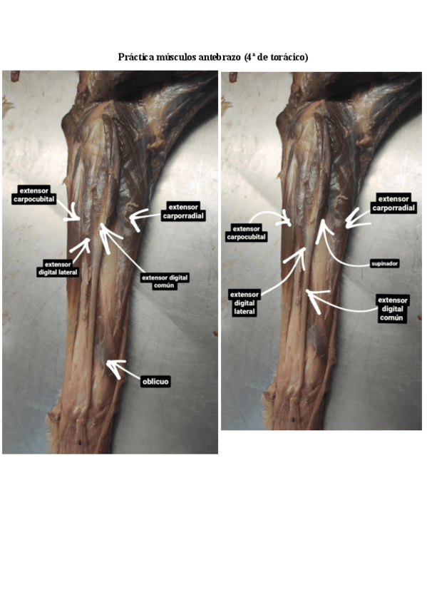 Miniatura del documento practica-antebrazo-4-fotos-musculos.pdf