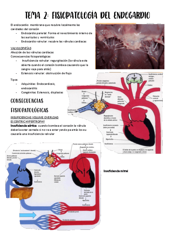 Miniatura del documento T.2-Fisiopatologia-del-endocardio.pdf