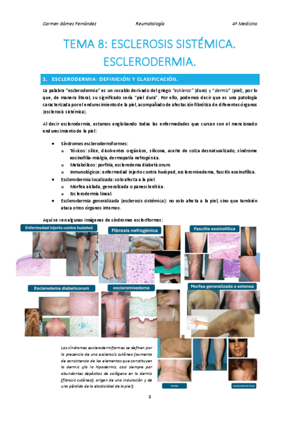 Miniatura del documento T8-Esclerodermia.pdf