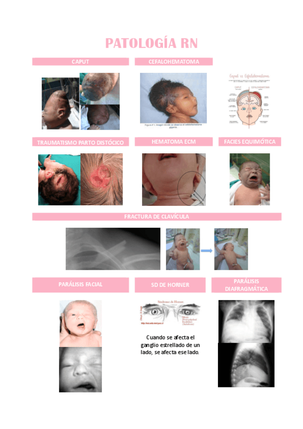 Miniatura del documento PATOLOGIA-RN.pdf