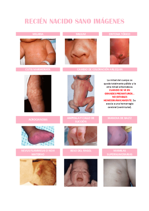 Miniatura del documento RECIEN-NACIDO-SANO-IMAGENES-arrastrado.pdf