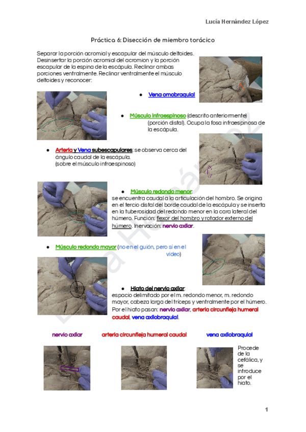 Miniatura del documento Practica-6-Diseccion-de-miembro-toracico.pdf