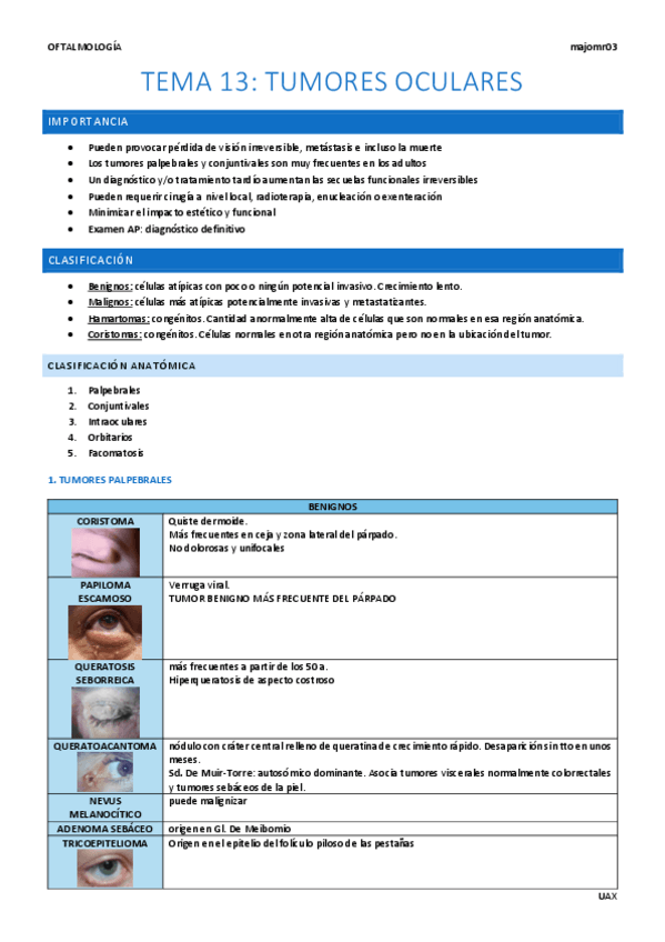 Miniatura del documento Tema-13-Tumores-oculares.pdf