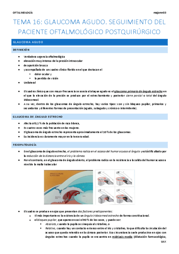 Miniatura del documento Tema-16-Glaucoma-agudo.pdf