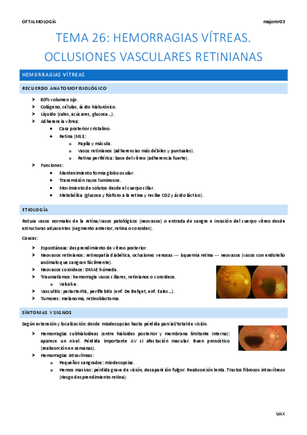 Miniatura del documento Tema-26-Hemorragias-vitreas.-Oclusiones-vasculares-retinianas.pdf