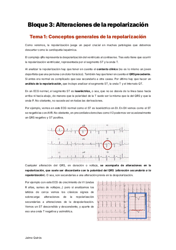 Miniatura del documento Bloque-3-Curso-ECG.pdf