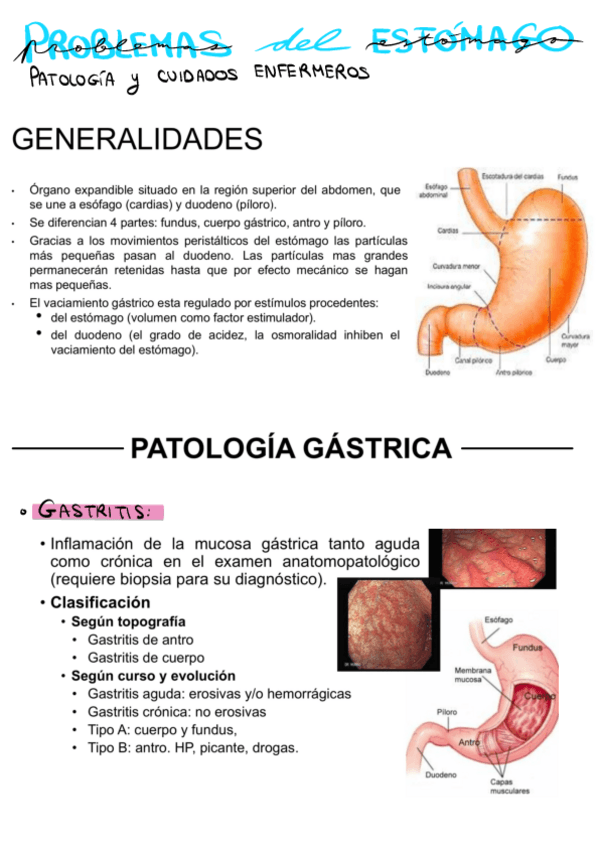 Miniatura del documento Problemas-Del-Estomago.pdf