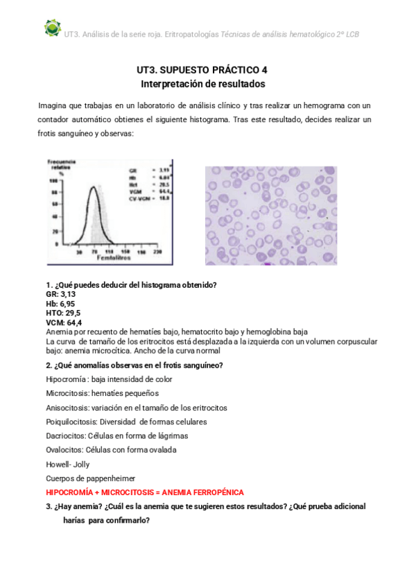 Miniatura del documento SUPUESTO-PRACTICO-4.pdf