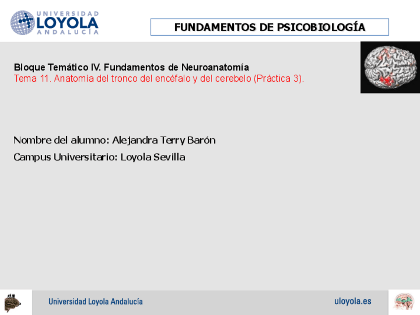 Miniatura del documento P3-T11Anatomia-Tronco-y-Cerebelo25-4.pdf