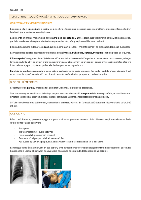 Miniatura del documento UT3-TEMA-6.-OVACE.pdf