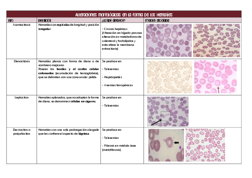 Miniatura del documento Alteraciones-morfologicas-en-la-forma-de-los-hematies.-TABLA.pdf