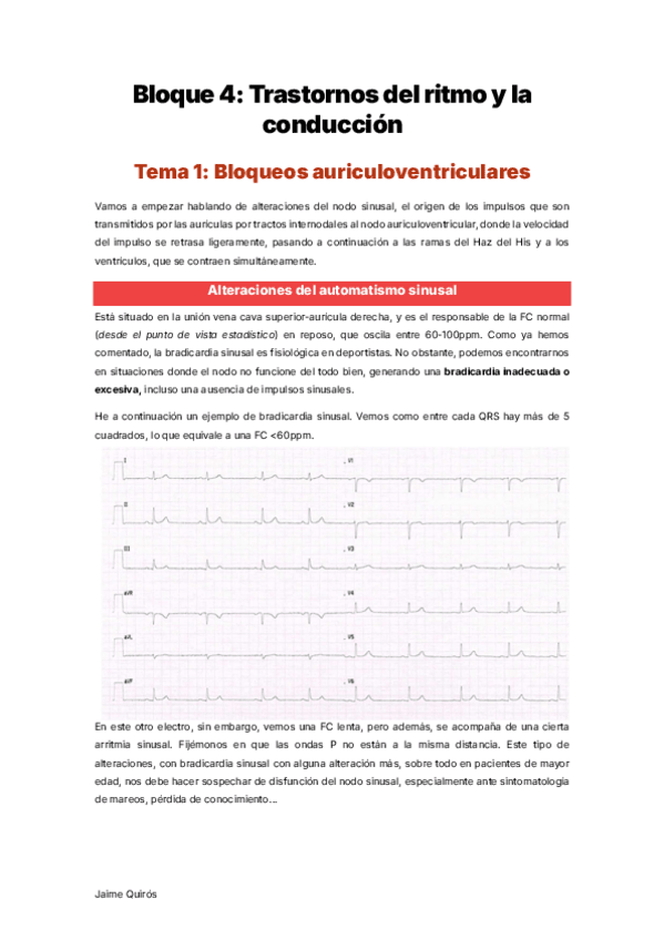 Miniatura del documento Bloque-4-Curso-ECG.pdf