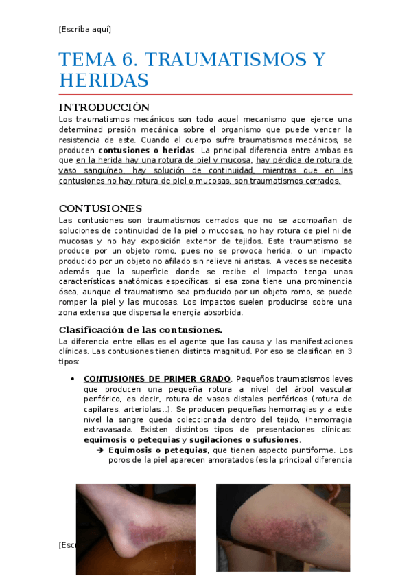 Miniatura del documento Tema 06. Traumatismos y heridas.docx