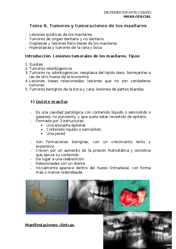 Miniatura del documento TEMA 8- TUMORES Y QUISTES MAXILARES Y CARA.docx