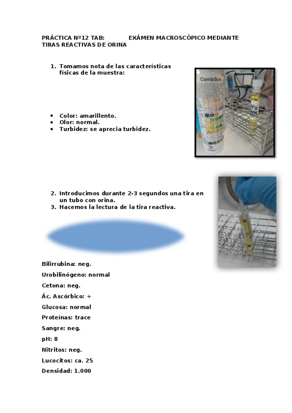 Miniatura del documento Orina-mediante-tiras-reactivas.docx