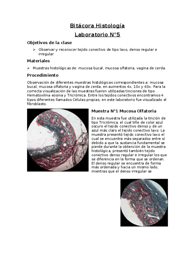 Miniatura del documento Tejido-conectivo-de-tipo-laxo-denso-regular-e-irregular.docx