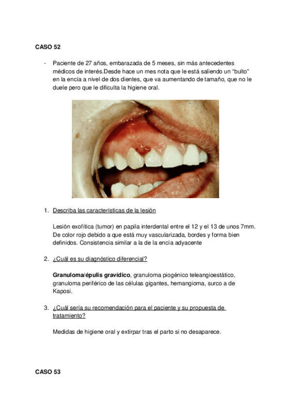 Miniatura del documento CASOS-52-56.docx