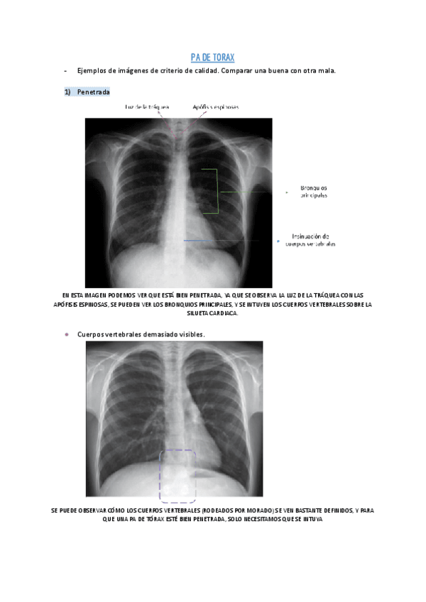 Miniatura del documento Cuaderno-de-fotos-radiograficas.pdf