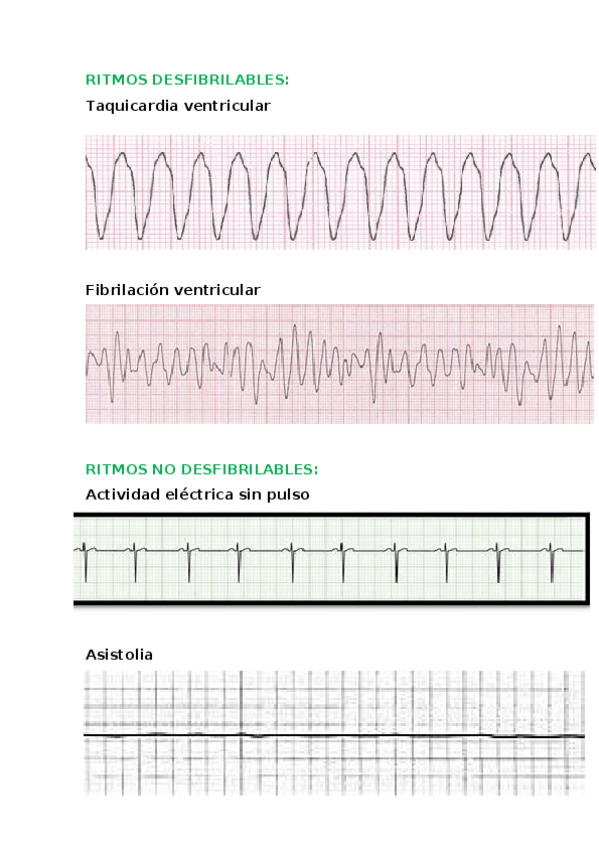 Miniatura del documento Ritmosdesfibrilablesynodesfibrilables.docx